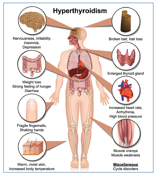 hypothyroidism skin rash