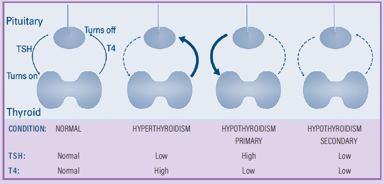 Hyperthyroidism Brochure Figure 2