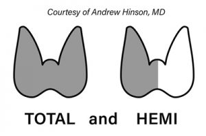 Thyroid Surgery